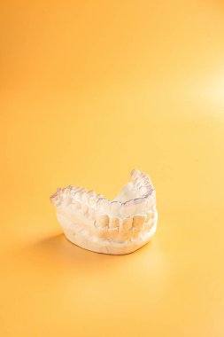 Telleri ya da hizalamayı başlat. Güzel bir gülümseme ve beyaz dişlere sahip olmanın bir yolu. Görünmez. Plastik diş tellerini incele.