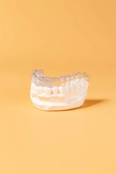 Zbliżenie Indywidualne Taca Zęby Ortodontyczny Motyw Stomatologiczny Ręku Niewidzialne Aparaty — Zdjęcie stockowe