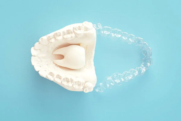 Orthodontic Dental Theme Blue Background Transparent Invisible Dental Aligners Braces — Stock Photo, Image