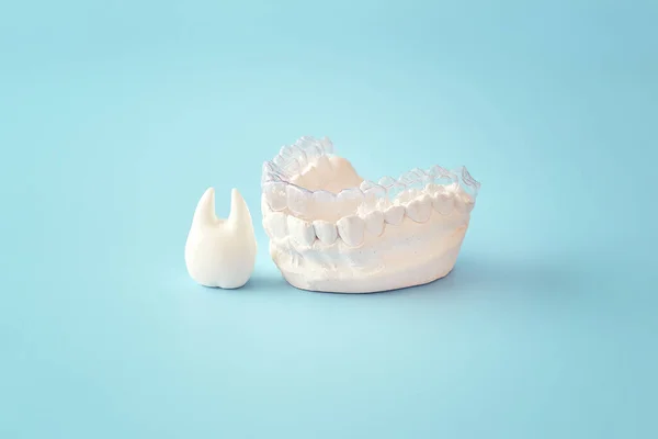 Kieferorthopädisches Zahnthema Auf Blauem Hintergrund Transparente Unsichtbare Zahnausrichtungen Oder Zahnspangen — Stockfoto