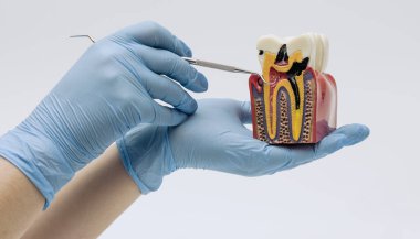 Dental Tooth Anatomy Model With Probe