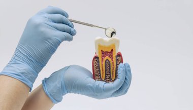 Diş Dişi Anatomisi Modeli İncelemesi