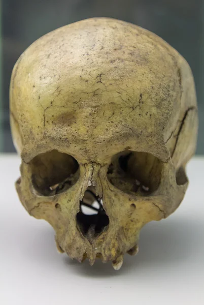 Details van een menselijke schedel — Stockfoto