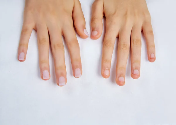 Mãos de mulher com unhas antes do tratamento — Fotografia de Stock