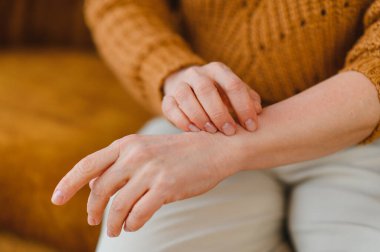 Kadının kolunda alerjik bir reaksiyon var. Kurumuş cildini kaşıyor. Rahatsızlık ve kaşıntı hissediyor.