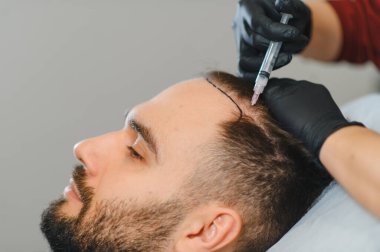 Trikoloğum, erkek hastalara mezoterapi uyguluyor. Saç dökülmesi ve kellik için kafa derisi yüzüyor.