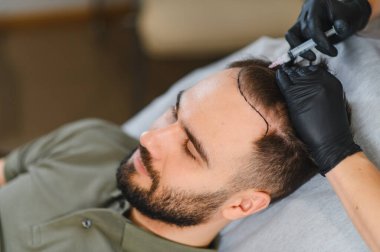 Adam saç yenilenmesi için bir prosedür uygulanıyor. Saç uzaması için kafa derisine iğne yapılıyor.