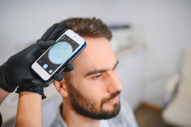 Trikoloğum, akıllı telefona bağlı trikop kullanarak saç dökülmesi için hastanın kafa derisini ve saç foliküllerini inceliyor.