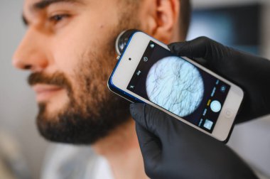 Uzman bir büyüteç kullanan eğitimli bir trikoloğum akıllı telefona bağlı, sakal kılı incelemesi için.