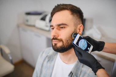 Bir adamın sakalını ve deri foliküllerini incelemek için akıllı telefon dermatoskobu kullanan bir dermatolog.