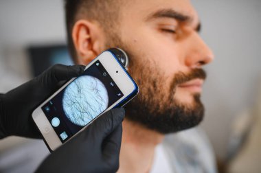 Trikoloğum, akıllı telefona bağlı bir dermatoskop kullanarak erkek sakal foliküllerini inceleyerek saç ve deri hastalığını teşhis ediyor.