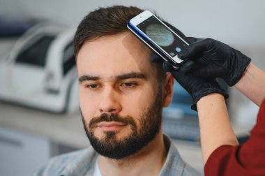 Erkek hasta, cep telefonuna takılı bir dermatoskop kullanarak trikoloji muayenesi sırasında saç ve kafa derisi kontrolü yaptırıyor.