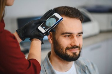 Kadın trikoloğu, akıllı telefondan özel bir eklenti kullanarak saç dökülmesi ve olası tedaviler için adamın kafa derisini inceliyor.