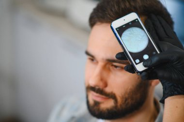 Bir klinikte saç kaybı ve kellik için kafa derisini özel bir dermatoskopla inceleyen profesyonel bir trikoloğum var.