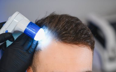 Siyah eldivenli trikoloğum bir adamın kafa derisini ve saç foliküllerini incelemek için dermatoskop kullanıyor. Tedavi için saç dökülmesini teşhis ediyor.