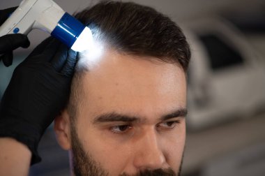 Trikoloğum erkek hastanın kafa derisini ve saçını dermatoskopla inceliyor. Tıbbi uzmanlar saç kaybını araştırıyor.