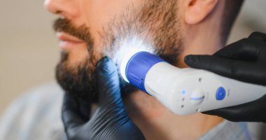 Bir hastanın sakalını ve derisini saç kaybı ve cilt bakımı için dermatoskopla inceleyen uzman trikoloğum.