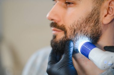 Uzman trikoloğum saç ve kafa derisi durumunu değerlendirmek için erkek bir hastanın sakalı ve derisi üzerinde dermatoskopik inceleme yapıyor.