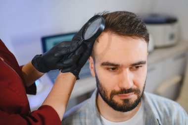 Siyah eldivenli trikoloğum klinikte saç kaybı teşhisi için bir büyüteçle kafa derisini inceliyor.