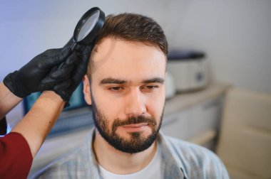 Erkek hasta saç sağlığı için trikoloji muayenesinden geçiyor. Bir uzman kafa derisini büyüteç kullanarak inceliyor.
