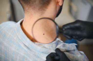 Cildiyeci, cilt sağlığı için bir büyüteçle hastanın boynundaki tehlikeli olabilecek bir beni kontrol ediyor.