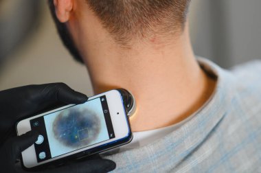 Dermatolog, cilt kanseri taraması için dermatoskop takılı akıllı telefon kullanarak hastanın boynundaki benleri kontrol ediyor.
