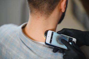 Doktor gezici dermatoskopla hastanın boynundaki beni inceliyor. Cilt kanseri ve sağlık taraması yapıyor.