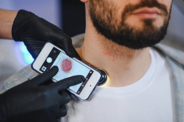 Doktor, akıllı telefon eklenti dermatoskopuyla hastanın boynundaki beni inceliyor. Cilt kanseri ve melanom taraması yapıyor.