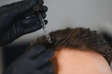 Saç uzmanı siyah eldiven takıyor. Tedavi serumu uyguluyor. Kafa derisine pipet takıyor.