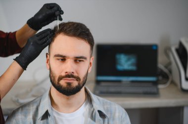 Bir trikoloji kliniğinde saç dökülmesi için kafa derisi tedavisi gören erkek hasta özel tıbbi ekipmanlar kullanıyor.