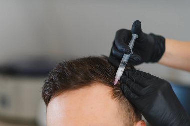 Saç terapisi prosedürü uygulayan kişi, saç uzamasını hızlandırmak için kafa derisine bir trikoloğun enjekte ettiği solüsyon.