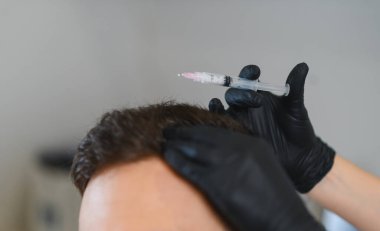 Saç yenilenmesi için kafa derisi iğnesi yaptıran kişi. Eldivenli bir el, folikülleri uyarmak için çözümü yönetir.