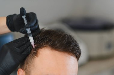 Trichologist bir adamın kafa derisine vitamin enjekte ediyor, saç uzamasını teşvik ediyor ve bir klinikte alopecia 'yı ele alıyor.