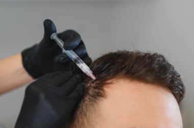 Profesyonel estetik kliniğinde saç kaybı ve kafa derisi sağlığı için mezoterapi gören hasta.