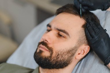 Uzanan bir adam, saç bakımı için kafa derisini ve saç çizgisini kalemle işaretleyen bir tıp uzmanı.