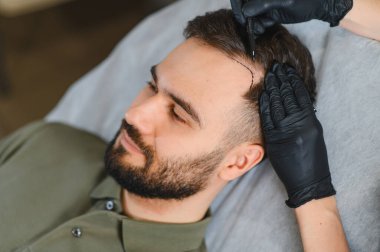 Doktor eldiven takıp bir klinikte saç nakli prosedürü için erkek hastanın kafasında çizgiler çiziyor.