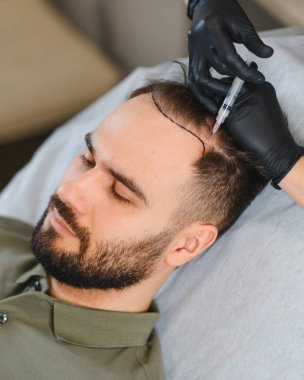 Tıbbi estetik kliniğinde saç büyütmek için kafa derisi aşısı olan hasta. Trikoloğum, erkeklerin kelliği için işlem yapıyor.