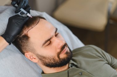 Adam saç dökülmesini önlemek ve büyümeyi canlandırmak için kafa derisine profesyonel bir enjeksiyon çözeltisi ile saç yenileme prosedürüne tabi tutuluyor.