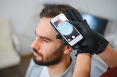 Trikoloğum, özel bir cihaz kullanarak erkek bir hastanın kafa derisini ve saç foliküllerini teşhis ediyor.