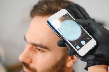 Trikoloğum saç kaybı ve olası kellik için dermatoskoba bağlı akıllı bir telefonla hastanın kafa derisini inceliyor.