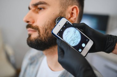 Trikoloğum, teşhis için akıllı telefona bağlı bir dermatoskopla erkek müşterinin sakalını ve derisini inceliyor.