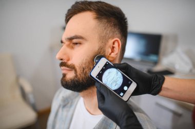 Sakal muayenesi yapılan erkek hasta, bir akıllı telefona bağlı tıbbi dermatoskopla saç foliküllerini ve deri sağlığını analiz ediyor.