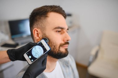 Trikoloğum, klinikte teşhis için dijital dermatoskop kullanarak sakal kılları ve kafa derisini inceliyor.