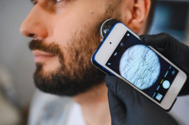 Yüzündeki saç ve folikülleri incelemek için seyyar dermatoskop kullanan bir erkek hastanın sakalını inceliyorum.