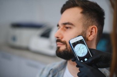 Doktor, bir klinik ziyareti sırasında saç foliküllerine odaklanarak akıllı telefona bağlı bir dermatoskopla adamın sakalını ve derisini inceliyor.