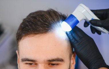 Siyah eldivenli trikoloğum, saç dökülmesi teşhisi için erkek hastanın saçını ve kafa derisini incelemek için özel bir cihaz kullanıyor.