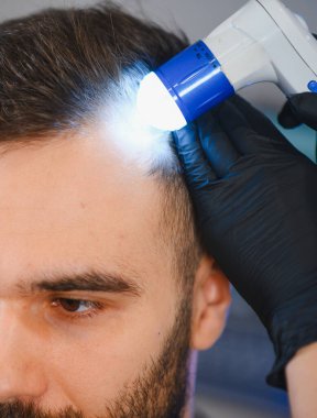 Dermatolog, bir adamın kafa derisini tıbbi bir aletle muayene ediyor. Klinikte saç kaybını ve olası tedavileri kontrol ediyor.