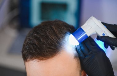 Trikoloğum, teşhis için özel bir trikop kullanan bir erkek hasta üzerinde detaylı kafa derisi ve saç muayenesi yapıyor.