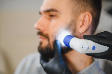 Trichologist, saç sağlığı sorunları için bir adamın sakalını ve cildini incelemek için dermatoskopla özel ışıklandırma uyguluyor.