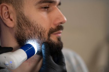 Erkek bir hastanın sakalını ve altında yatan dermatoskop kullanarak saç foliküllerini ve durumunu inceleyen uzman bir trikoloğum.